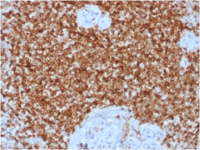 FFPE human spleen sections stained with 100 ul anti-bcl-2 (clone BCL2/1878R) at 1:50. HIER epitope retrieval prior to staining was performed in 10mM Tris 1mM EDTA, pH 9.0.